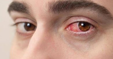Mutirão oftalmológico na Paraíba: 29 pacientes têm complicações e sete passarão por cirurgia