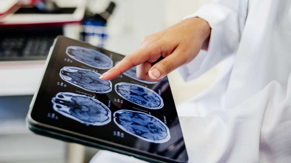 Mente Brilhante: Estudo Revela que o Cérebro Humano Emite Luz e Abre Nova Janela Para a Consciência