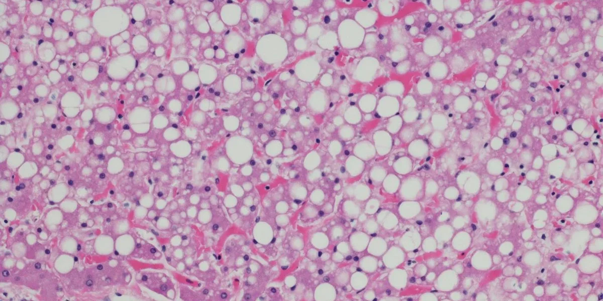 Cérebro flex: estudo mostra que neurônios também usam gordura como combustível