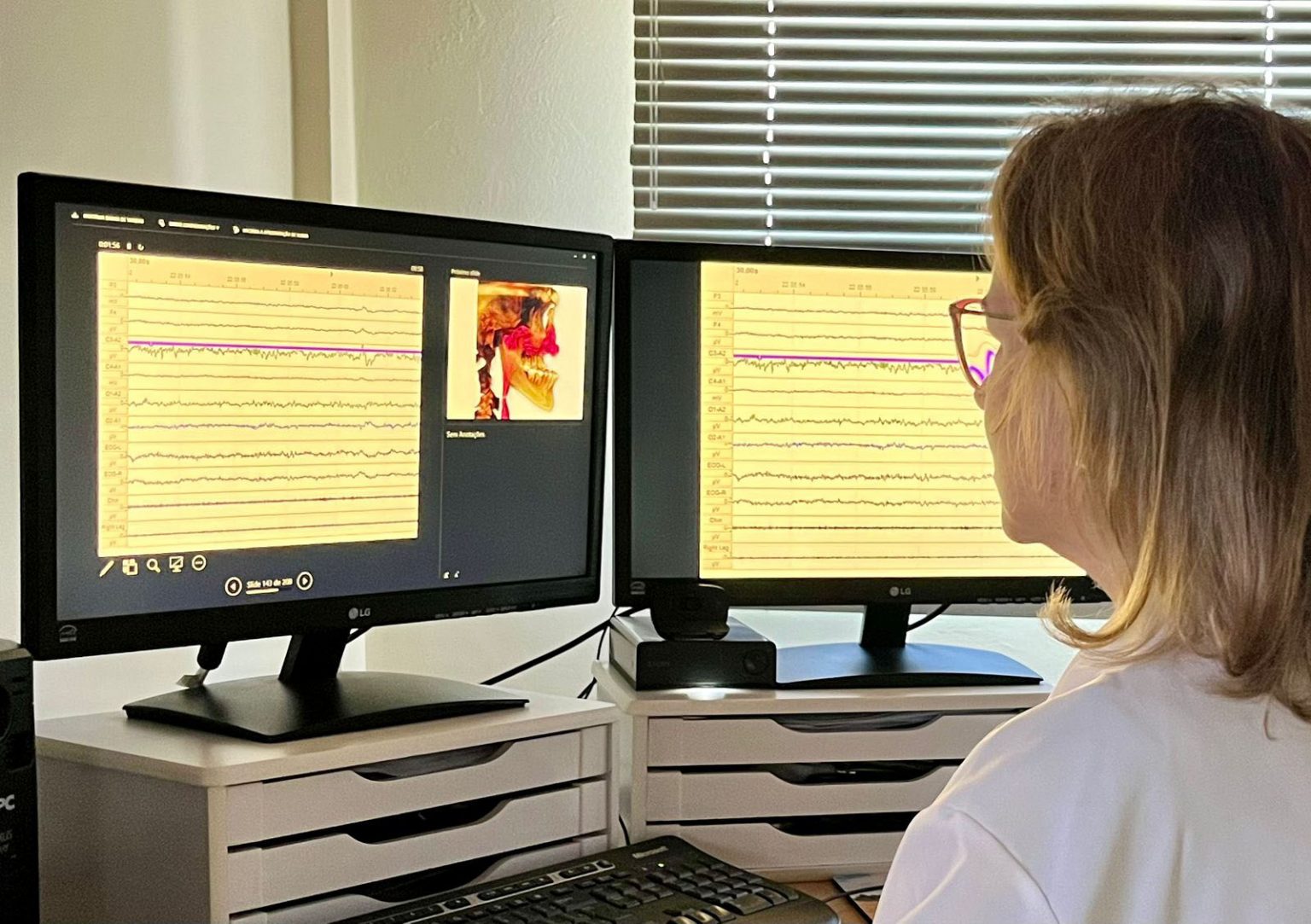 FOB-USP lidera novo Projeto Temático FAPESP em apneia do sono