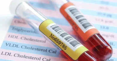 Colesterol alto: A pele dá o recado, saiba identificar! Colesterol alto: A pele dá o recado, saiba identificar!