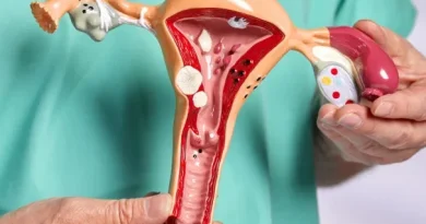 Endometriose: o silêncio de uma década que afeta uma em cada dez mulheres Endometriose: o silêncio de uma década que afeta uma em cada dez mulheres