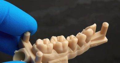 SUS integra tecnologia 3D para reconstrução dentária de vítimas de violência