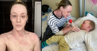 Retirada de Esteroides: O Que os Médicos Não Concordam