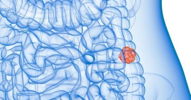SUS adota teste de fezes para rastreamento de câncer de intestino