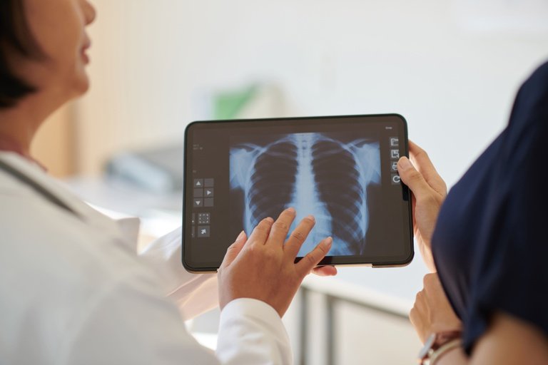 Anvisa aprova novo tratamento para hipertensão pulmonar